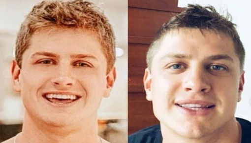 Lucas Gallina passa por procedimento estético