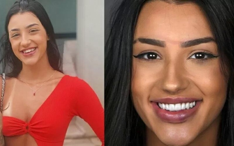 Bia Miranda gasta R$ 27 mil com preenchimento e lentes; veja antes e depois