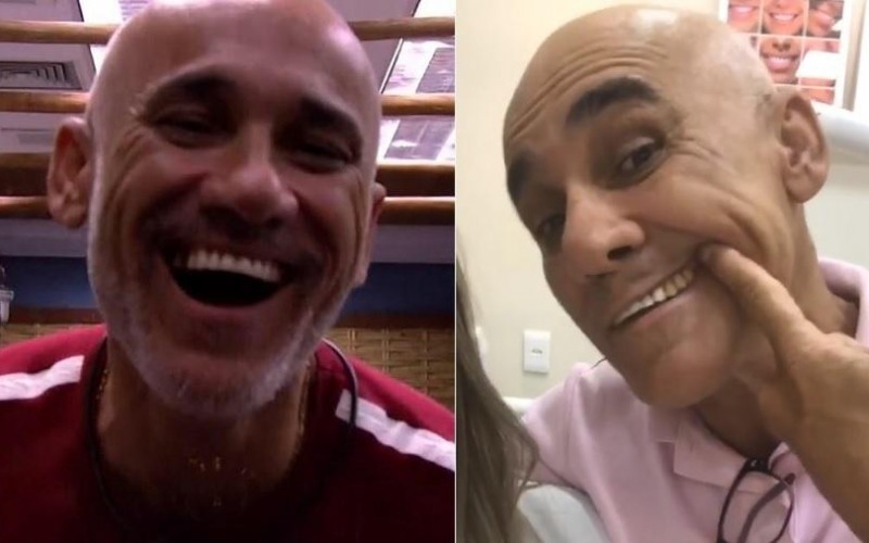 Ayrton conserta sorriso após perder dente no "BBB18": "Quase perfeito"